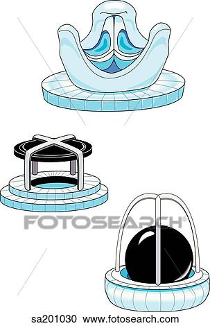 Clipart - Three different types of mechanical valves used to replace the valves of the heart.. Fotosearch