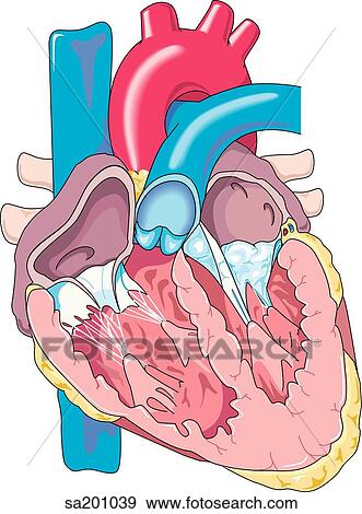 Stock Illustration - Transverse section of the heart showing stenosis of the mitral and tricuspid valves.. Fotosearch