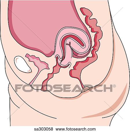 Stock Illustration - Abnormal positions of the uterus, retroflexion.. Fotosearch