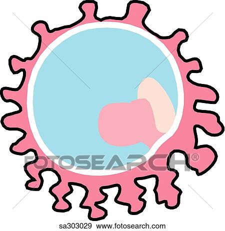 Stock Illustration -  an ovarian ectopic pregnancy.. Fotosearch