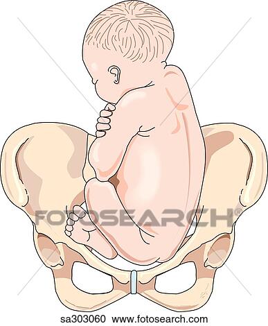 Anterior view of a maternal pelvis with a full term fetus in a breech presentation position. View Large Illustration Clipart - Anterior view of a maternal pelvis with a full term fetus in a breech presentation position.. Fotosearch