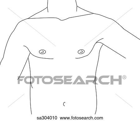 Clipart - Artificial heart.. Fotosearch