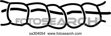 External sutures for pacemaker in location 1. View Large Illustration Stock Illustration - External sutures for pacemaker in location 1.. Fotosearch