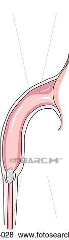 Frontal view of renal pelvis. View Large Illustration Stock Illustration - Frontal view of renal pelvis.. Fotosearch
