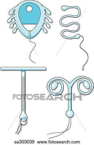 Image showing four types of intrauterine devices (IUDs). View Large Illustration Stock Illustration - Image showing four types of intrauterine devices (IUDs).. Fotosearch