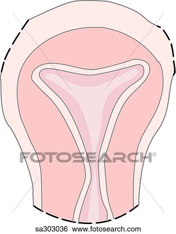 Image showing highlighted uterus which is removed during a hysterectomy. View Large Illustration Stock Illustration - Image showing highlighted uterus which is removed during a hysterectomy.. Fotosearch