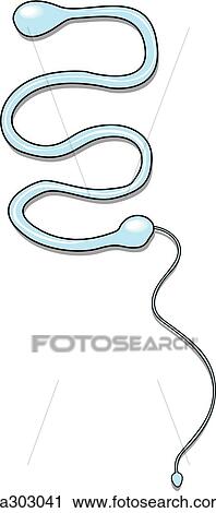 Clip Art - Intrauterine device, Lippes loop.. Fotosearch