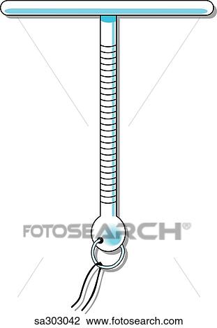 Drawing - Intrauterine device, TCu-200B.. Fotosearch