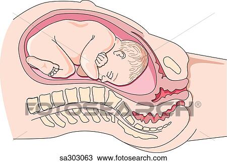 Drawing - Position of a full term fetus within the uterus during the initial stages of delivery.. Fotosearch