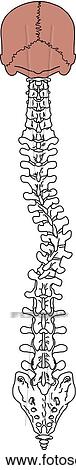 Posterior view of spinal column with lateral curvature of spine as a result of scoliosis. View Large Illustration Stock Illustration - Posterior view of spinal column with lateral curvature of spine as a result of scoliosis.. Fotosearch