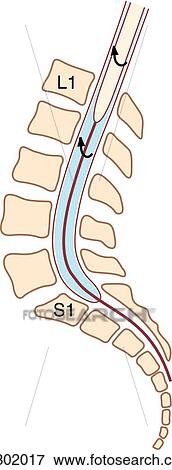 Sagittal view of brain illustrating the directional flow of cerebrospinal fluid through the ventricles. View Large Illustration Stock Illustration - Sagittal view of brain illustrating the directional flow of cerebrospinal fluid through the ventricles.. Fotosearch