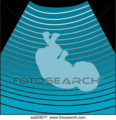Sonogram. View Large Illustration Stock Illustration - Sonogram.. Fotosearch