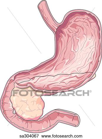Stomach and pancreas. View Large Illustration Stock Illustration - Stomach and pancreas.. Fotosearch