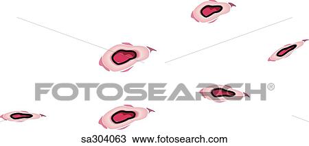 Stomach ulcers. View Large Illustration Drawing - Stomach ulcers.. Fotosearch