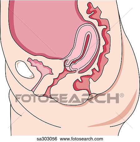 The less common retroversion position of the uterus. View Large Illustration Stock Illustration - The less common retroversion position of the uterus.. Fotosearch