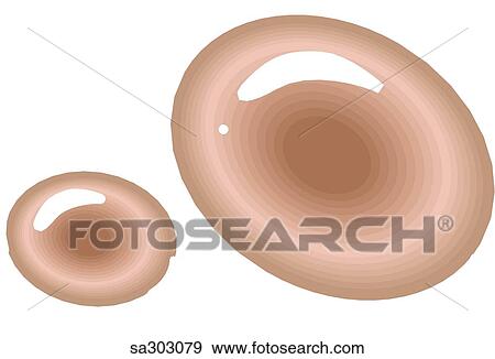 Uterine pathology, type 1. View Large Illustration Stock Illustration - Uterine pathology, type 1.. Fotosearch