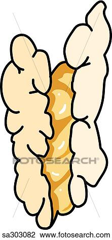 Uterine pathology, type 4. View Large Illustration Drawing - Uterine pathology, type 4.. Fotosearch