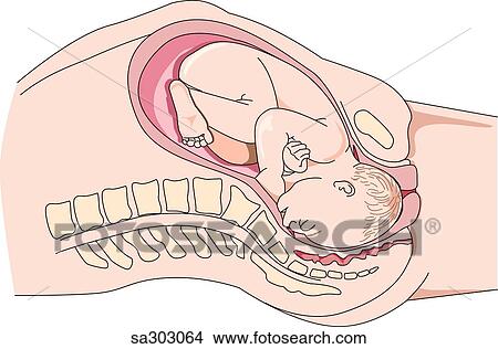full term vaginal Full term vaginal