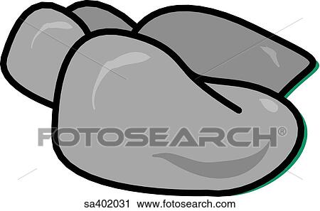 Gallstone in the fundus of the gallbladder. View Large Illustration Clip Art - Gallstone in the fundus of the gallbladder.. Fotosearch