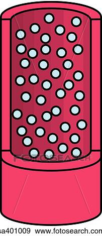 High blood glucose level. View Large Illustration Stock Illustration - High blood glucose level.. Fotosearch