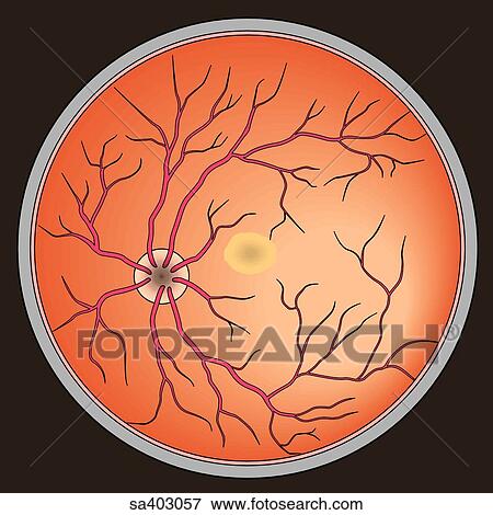 Illustration of the eyeground; the inner surface of the eye as seen through pupil on ophthalmoscopic examination. View Large Illustration Stock Illustration - Illustration of the eyeground; the inner surface of the eye as seen through pupil on ophthalmoscopic examination.. Fotosearch