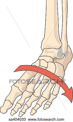 Drawing - Illustration of torsion injury to ankle.. Fotosearch