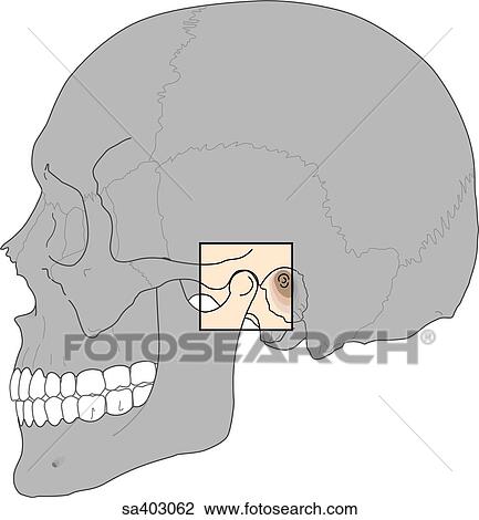 Drawing - Lateral view of skull featuring temporomandibular joint.. Fotosearch