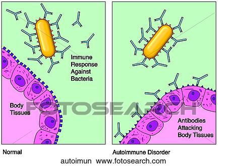 Stock Illustration - Autoimmunity. Fotosearch