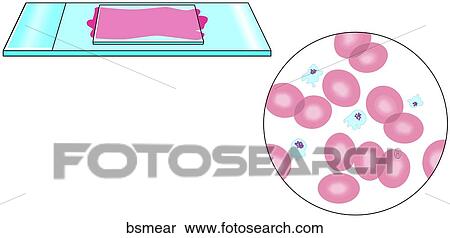 Blood Smear Test View Large Illustration Stock Illustration - Blood Smear Test. Fotosearch