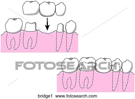 Clip Art - . Fotosearch