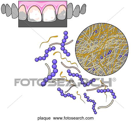 Clip Art - . Fotosearch