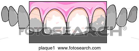 Clip Art - . Fotosearch
