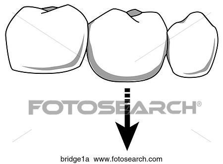 Clipart - . Fotosearch