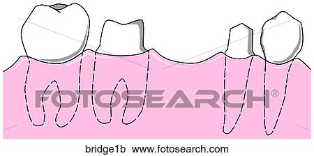 Clipart - . Fotosearch