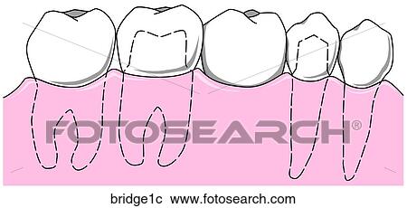 View Large Illustration Clipart - . Fotosearch