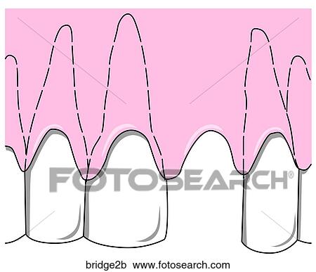 Clipart - . Fotosearch