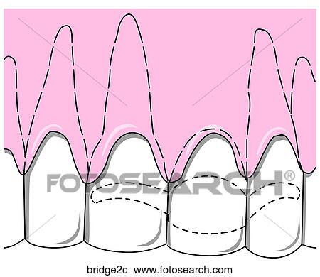Clipart - . Fotosearch