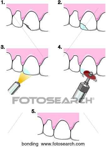 Drawing - . Fotosearch