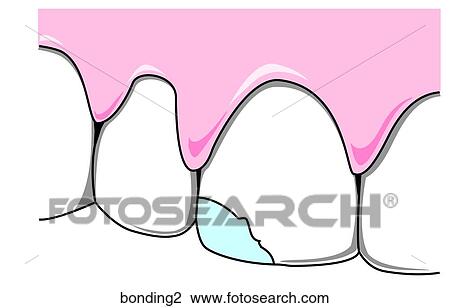 Drawing - . Fotosearch