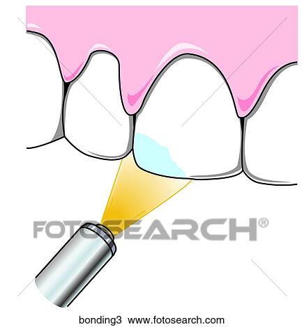 Drawing - . Fotosearch