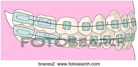 Drawing - . Fotosearch