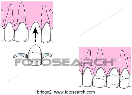 Drawing - . Fotosearch