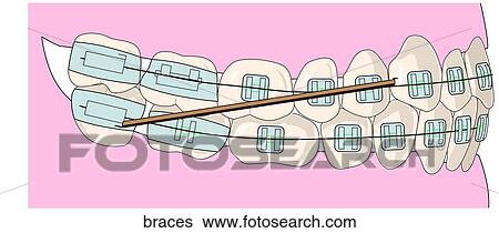 View Large Illustration Stock Illustration - . Fotosearch