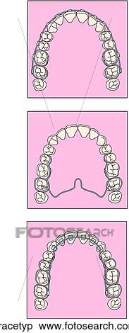Stock Illustration - . Fotosearch