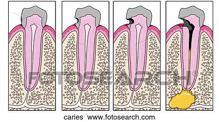 Stock Illustration - . Fotosearch