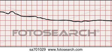 EKG wave showing asystole or absence of muscle contractions of the heart. View Large Illustration Stock Illustration - EKG wave showing asystole or absence of muscle contractions of the heart.. Fotosearch