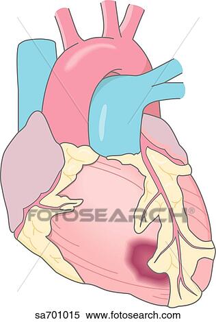 Heart icon from graph of elevated enzyme activity versus days after onset of cardiac infarct. View Large Illustration Stock Illustration - Heart icon from graph of elevated enzyme activity versus days after onset of cardiac infarct.. Fotosearch