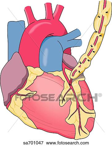 Illustration of supplemental blood supply to heart by internal mammary artery after bypass surgery. View Large Illustration Stock Illustration - Illustration of supplemental blood supply to heart by internal mammary artery after bypass surgery.. Fotosearch