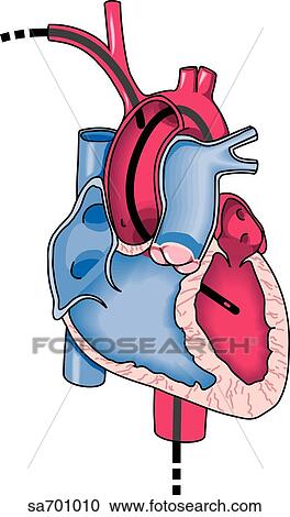 Clipart - Image shows the routes into the heart via the descending aorta and the subclavian artery.. Fotosearch