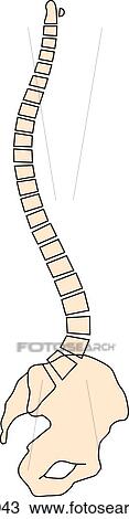 Drawing - Increased forward curvature of of lumbar spine known as lordosis.. Fotosearch